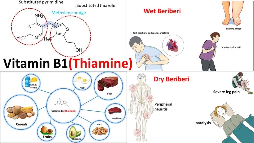 Benefits Of Thiamine (Vitamin B1) » The Nutraceutical Database